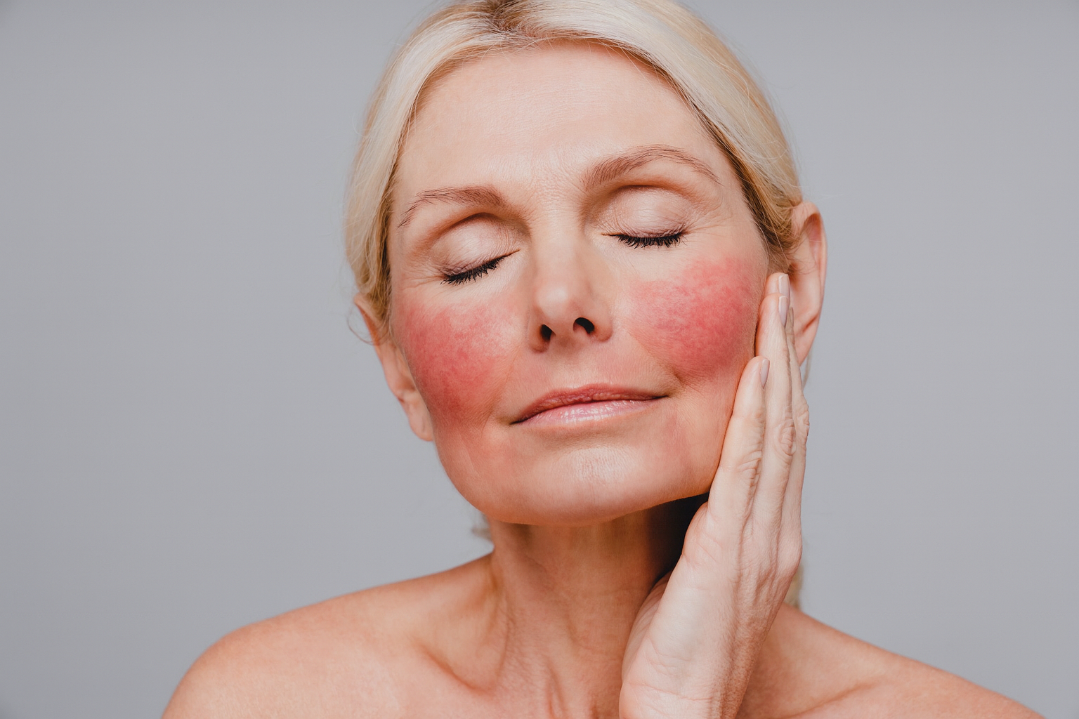 Rode vlekken in het gezicht